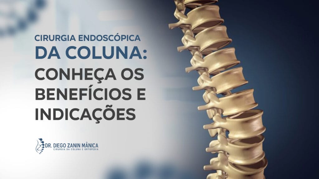 Cirurgia endoscópica da coluna em Presidente Prudente