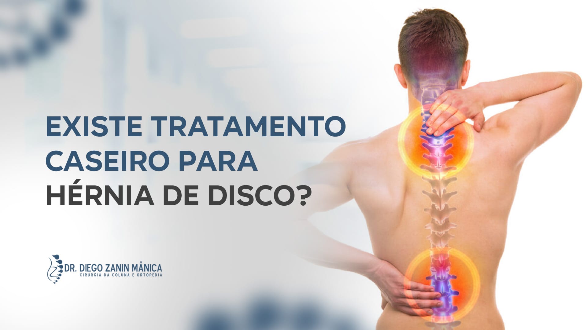 Existe tratamento caseiro para hérnia de disco?