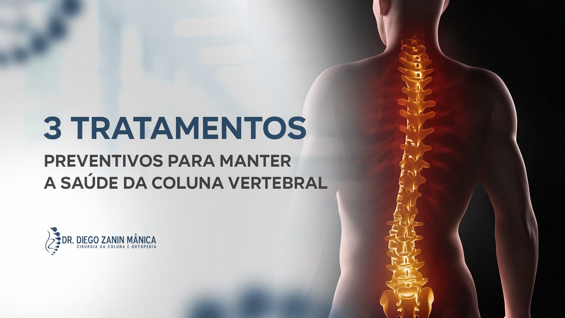 3 tratamentos preventivos para manter a saúde da coluna vertebral