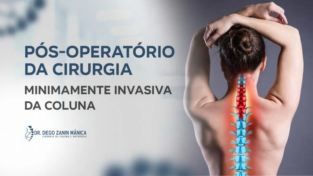 Pós-operatório da cirurgia minimamente invasiva da coluna
