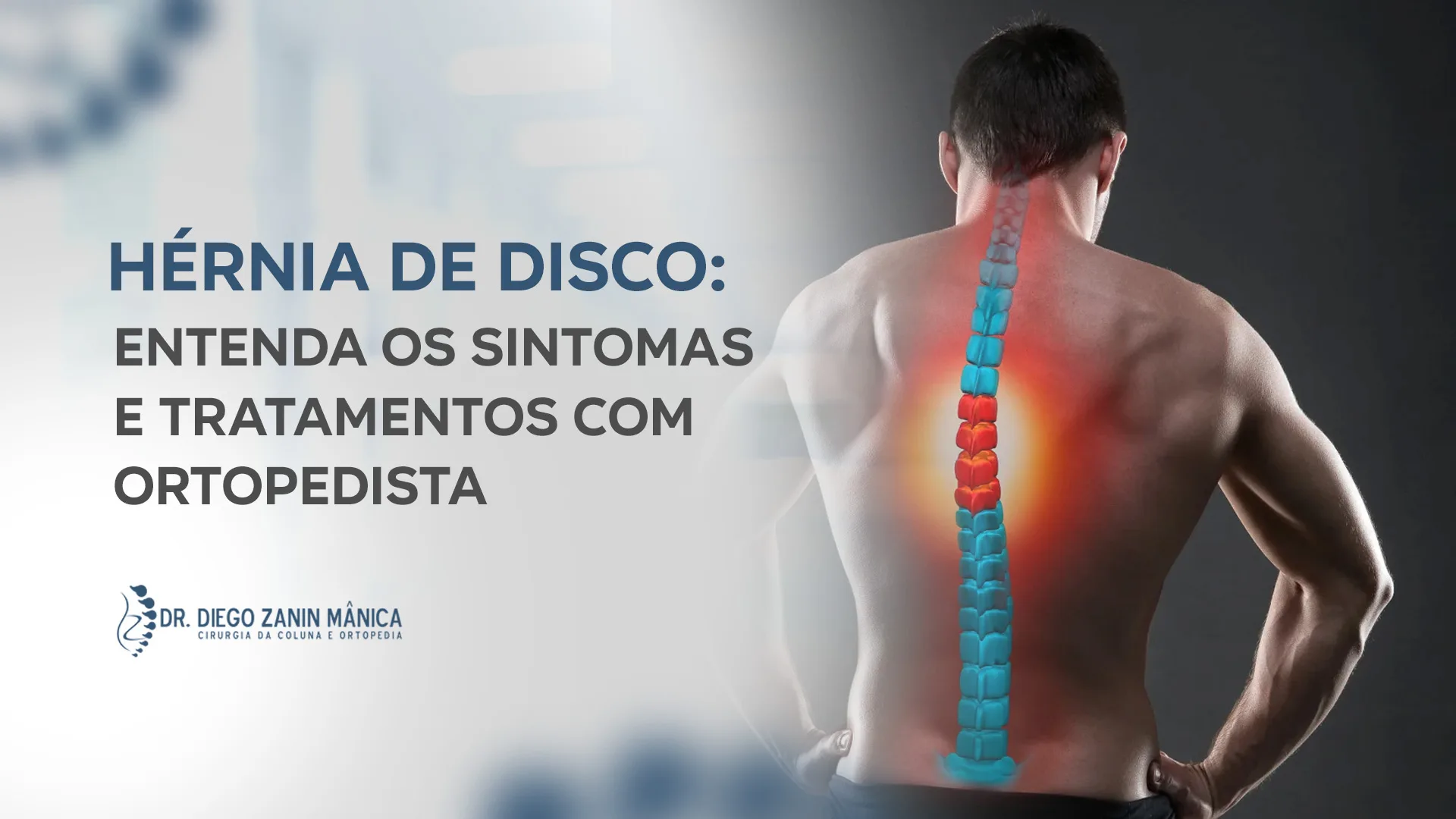 Hérnia de Disco: Sintomas e Tratamentos | Ortopedista