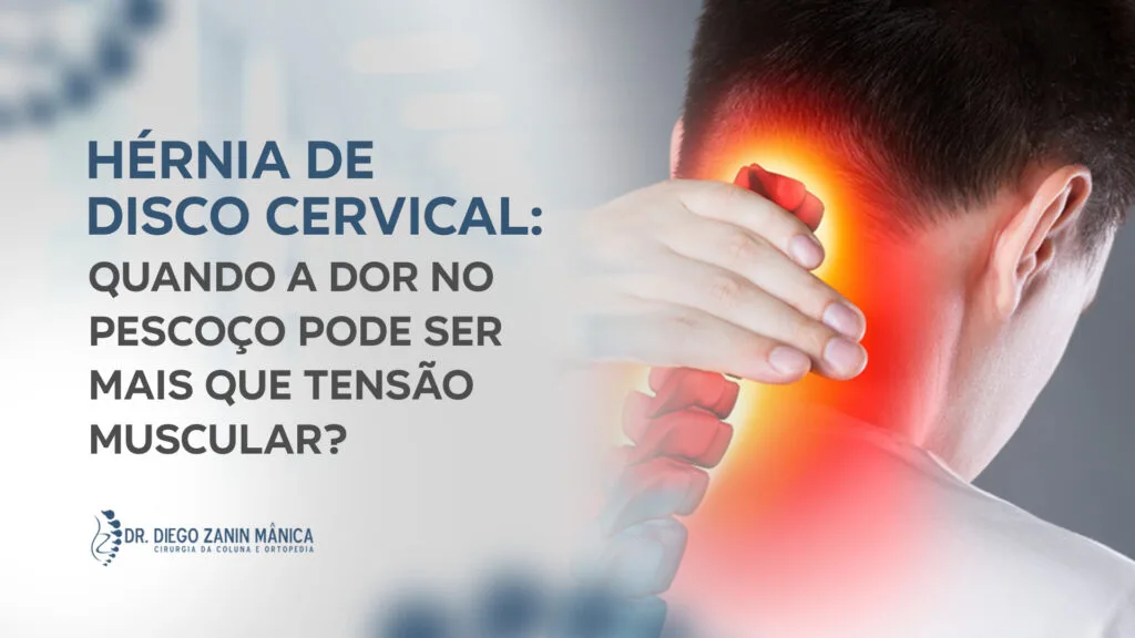 Hérnia de disco cervical: Quando buscar ortopedista em Prudente